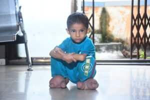 Dipali Rajendra Rajput   | Disability – Person with Locomotor Disability | India